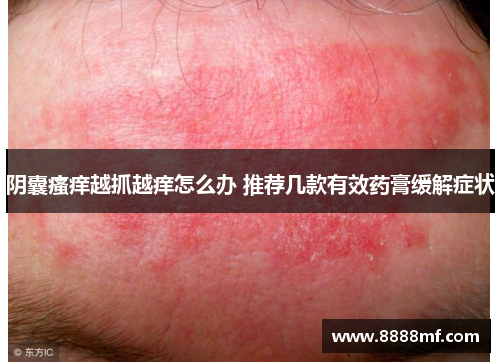 阴囊瘙痒越抓越痒怎么办 推荐几款有效药膏缓解症状